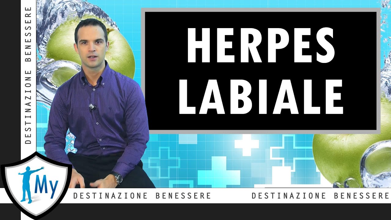 Herpes Labiale