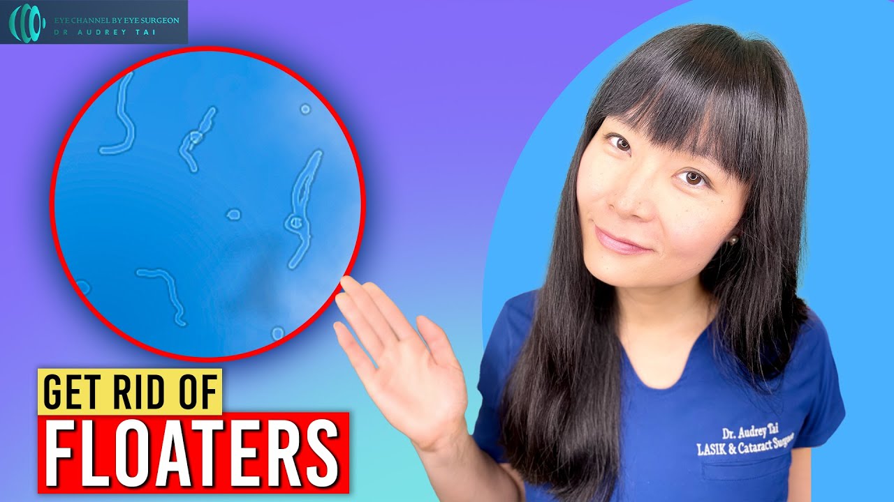 How to Get Rid of Eye Floaters | Everything You Need to Know | Eye Surgeon Explains #draudreytai