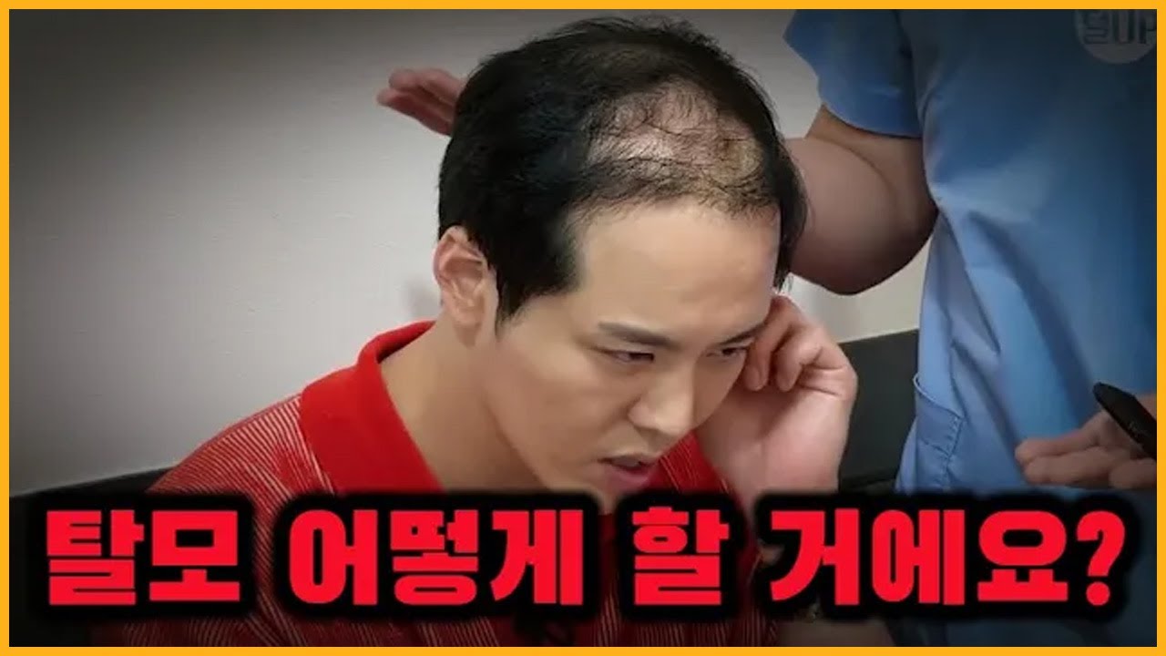 [모발이식] 탈모 해결, 진짜 가능한겁니까? | 18년차 탈모인의 현재 상태 |
