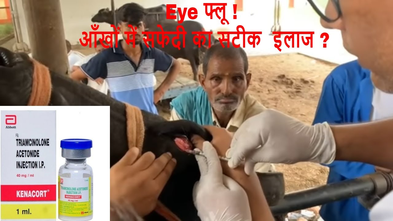 Eye Flu in Buffalo? Treatment of Corneal Opacity ! Cloudy Eye ! Pink Eye ! Conjunctivitis !