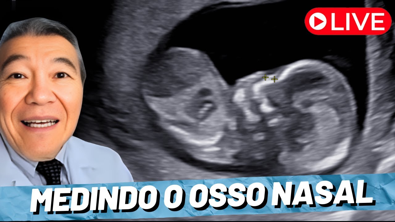 AO VIVO: MEDINDO O OSSO NASAL!