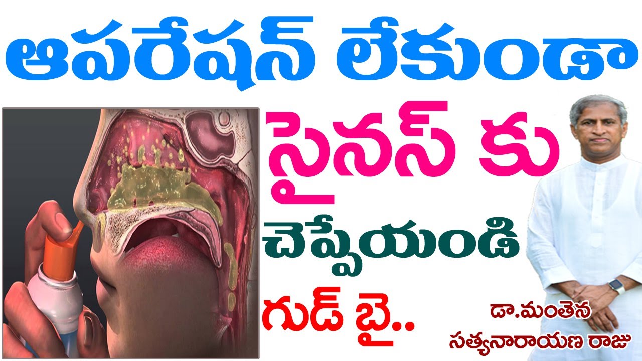 ఆపరేషన్ లేకుండా సైనస్ తగ్గాలంటే? | Dr Manthena Satyanarayana Raju | Sinus Tips | Good Health