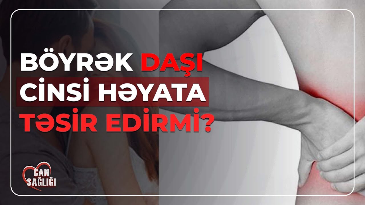 Ev şəraitində böyrək daşını necə salmaq olar? - Can Sağlığı (08.04.2024)
