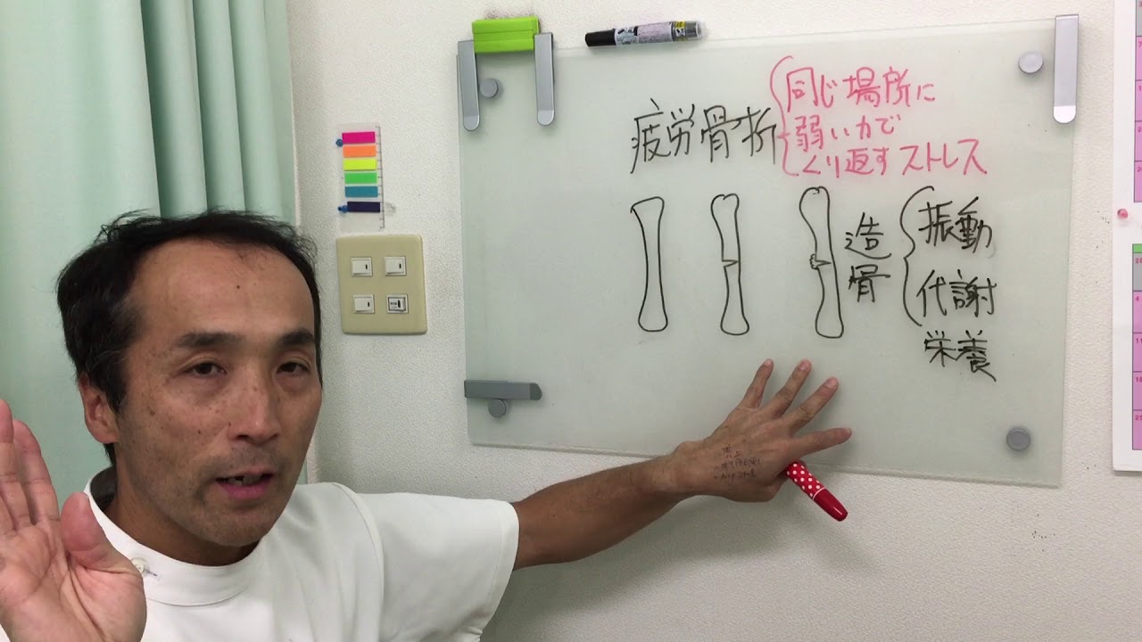 疲労骨折の治療法　東広島の整体院　ボディバランス整骨院2018 01 08 20 12 06