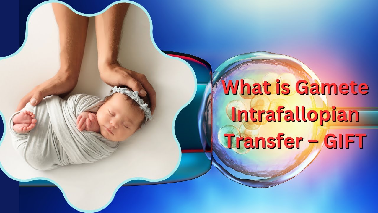 Gamete Intrafallopian Transfer (GIFT): The Future of Fertility Treatment