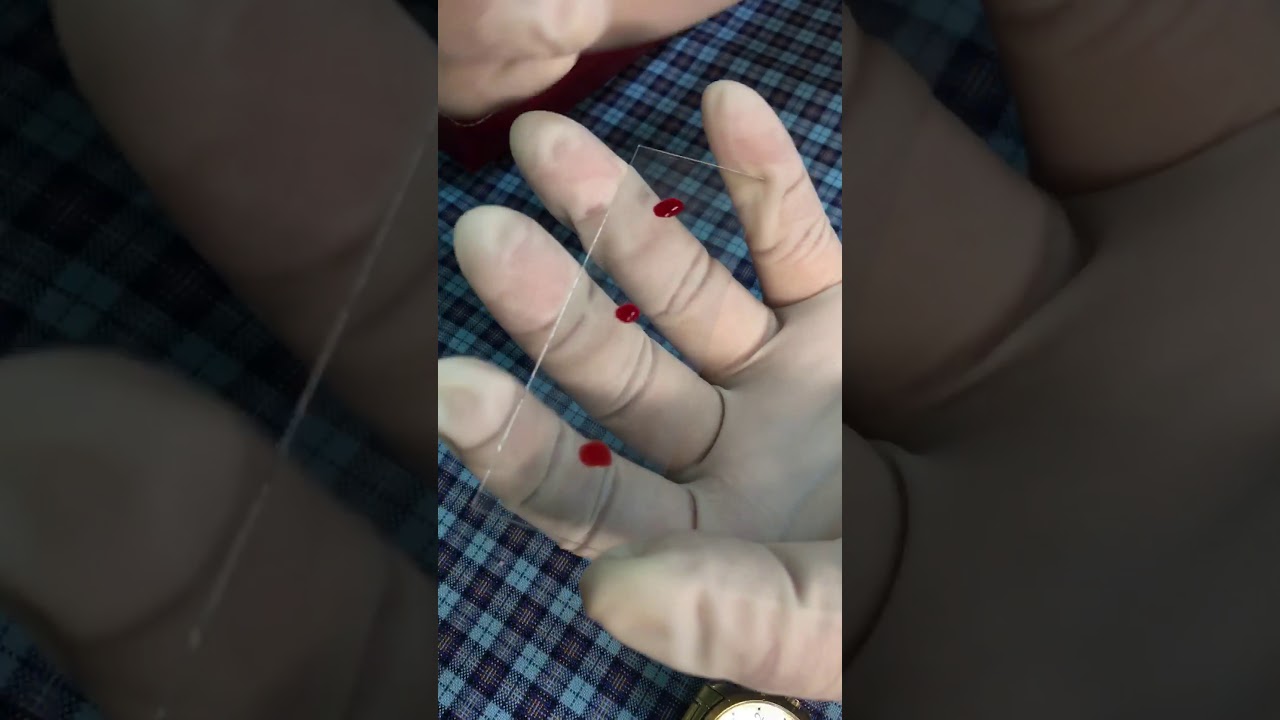 Coagulation time Micro Method Slide Method