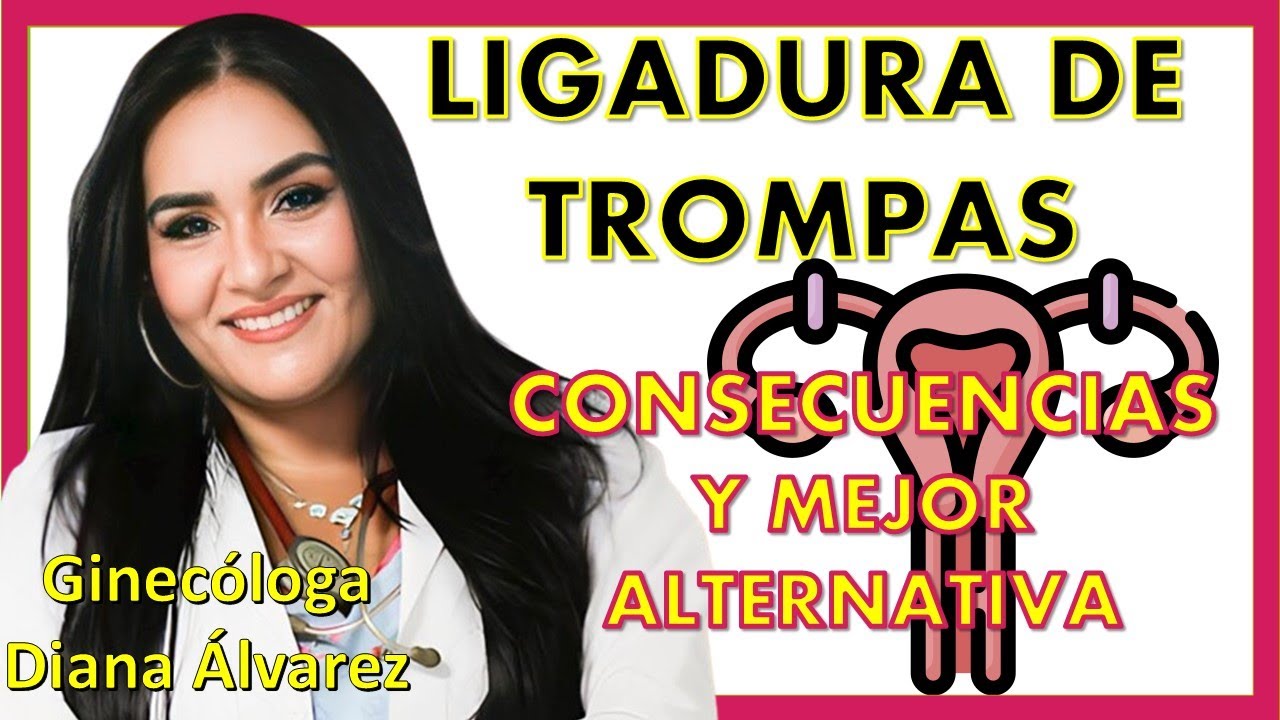 LIGADURA DE TROMPAS, CONSECUENCIAS Y RECOMENDACIONES. | Ginecologa Diana Alvarez