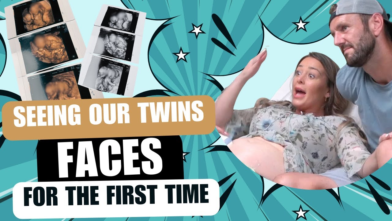 17 WEEK ULTRASOUND: Seeing our Twins' Faces for the *FIRST TIME* in 4D! 
