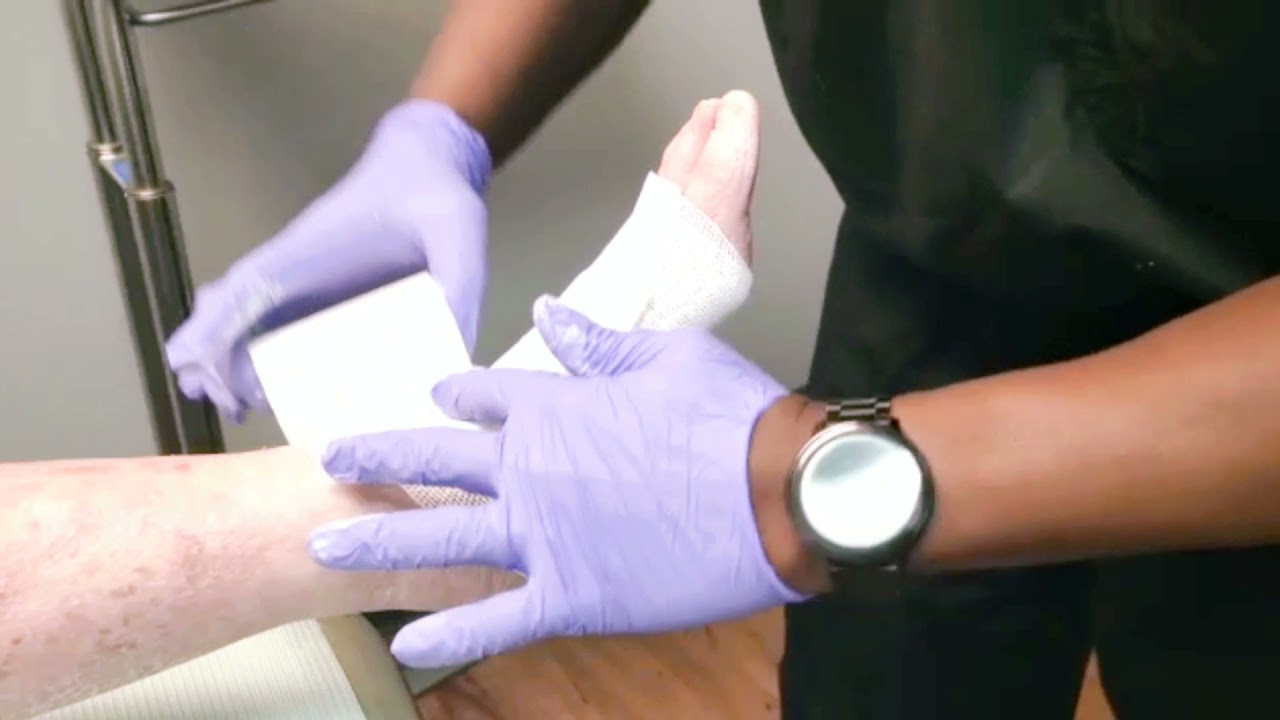 Unna Boot Application by Podiatrist, Dr. Ejiro Isiorho