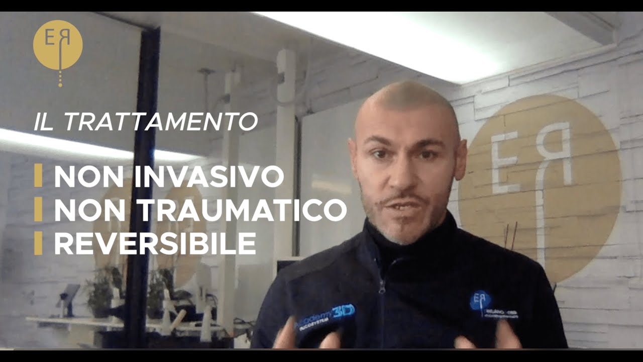 La Tricopigmentazione per calvizie e alopecia - A cosa serve? &Egrave; reversibile?