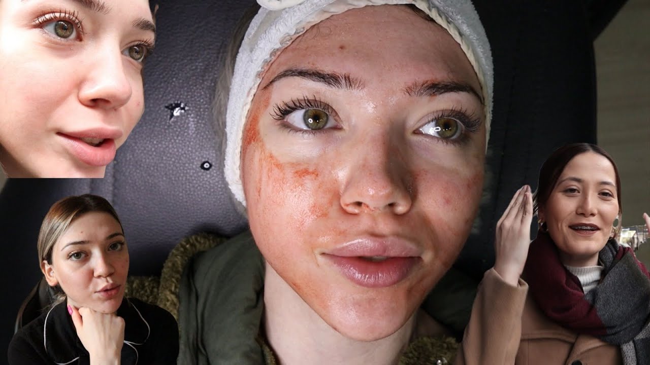 DERMAPEN YAPTIRDIM! | GÜNLÜK VLOG