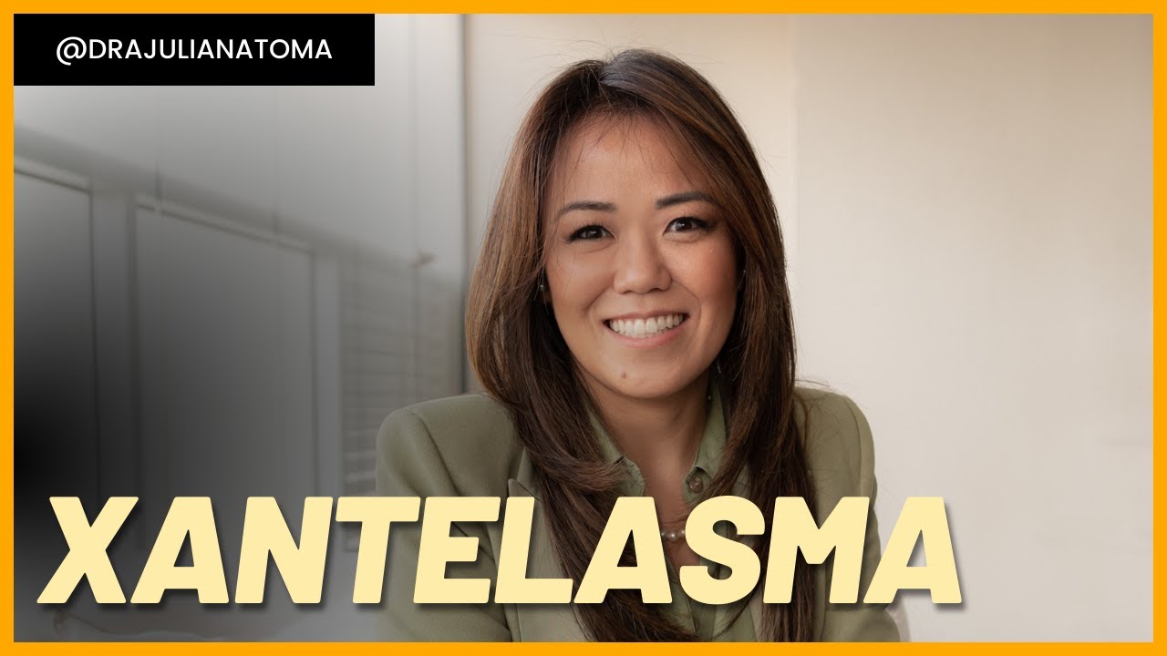 Xantelasma (Bolsas nas Pálpebras) - Como Tratar ┃Dra. Juliana Toma