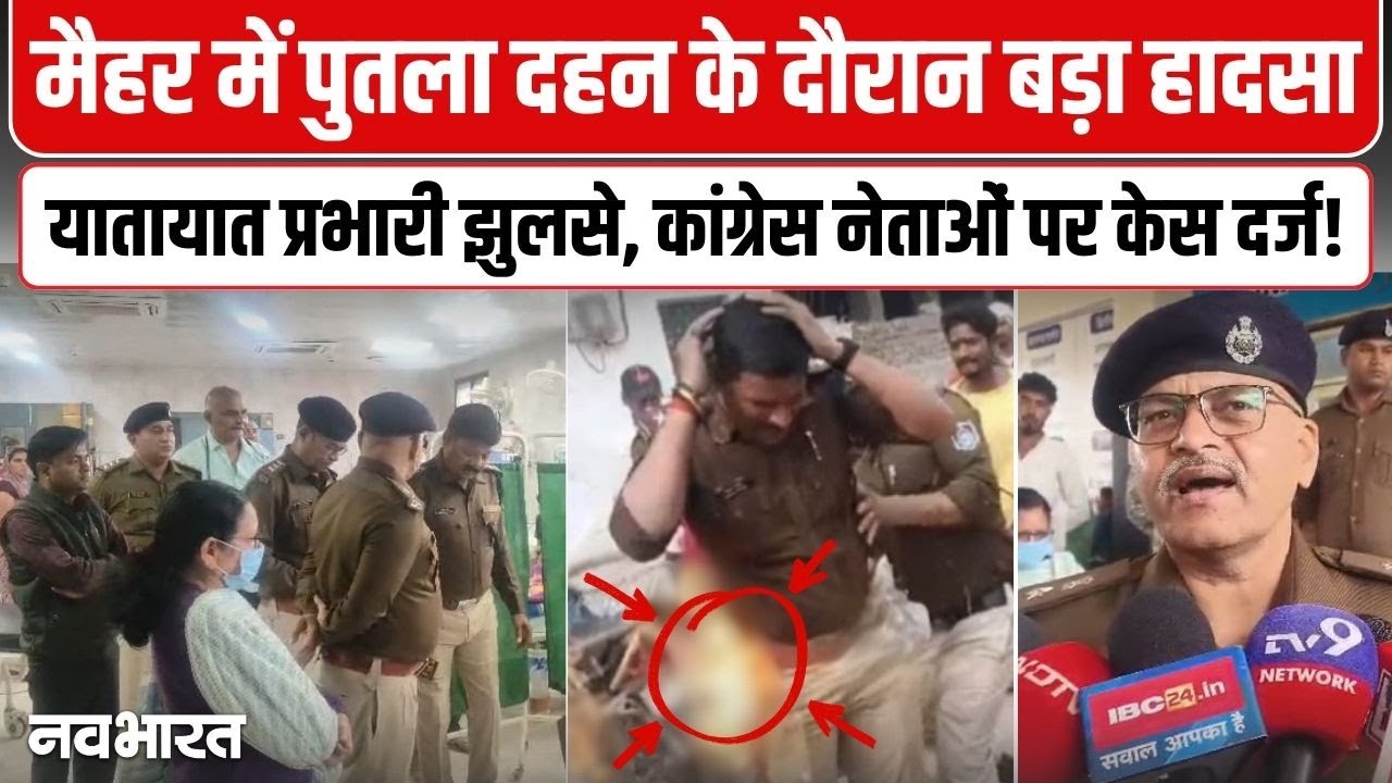 मैहर में पुतला दहन के दौरान बड़ा हादसा, कांग्रेस के प्रदर्शन में यातायात प्रभारी झुलसे | MP News
