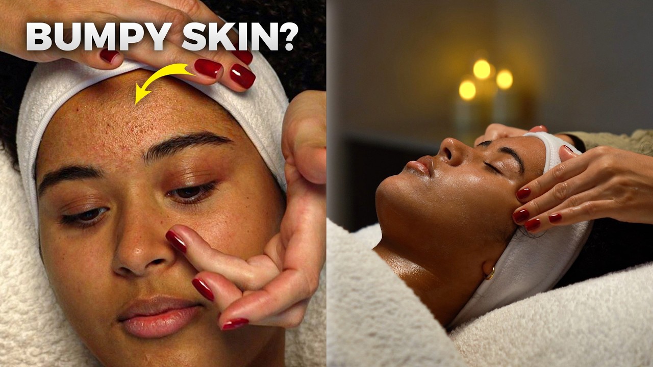 Textured, Bumpy Skin? This Facial Clears It
