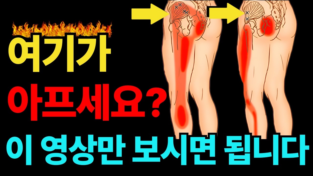 업계비밀 공개합니다. 허리문제가 아니라 사실 '이것'때문이였습니다!