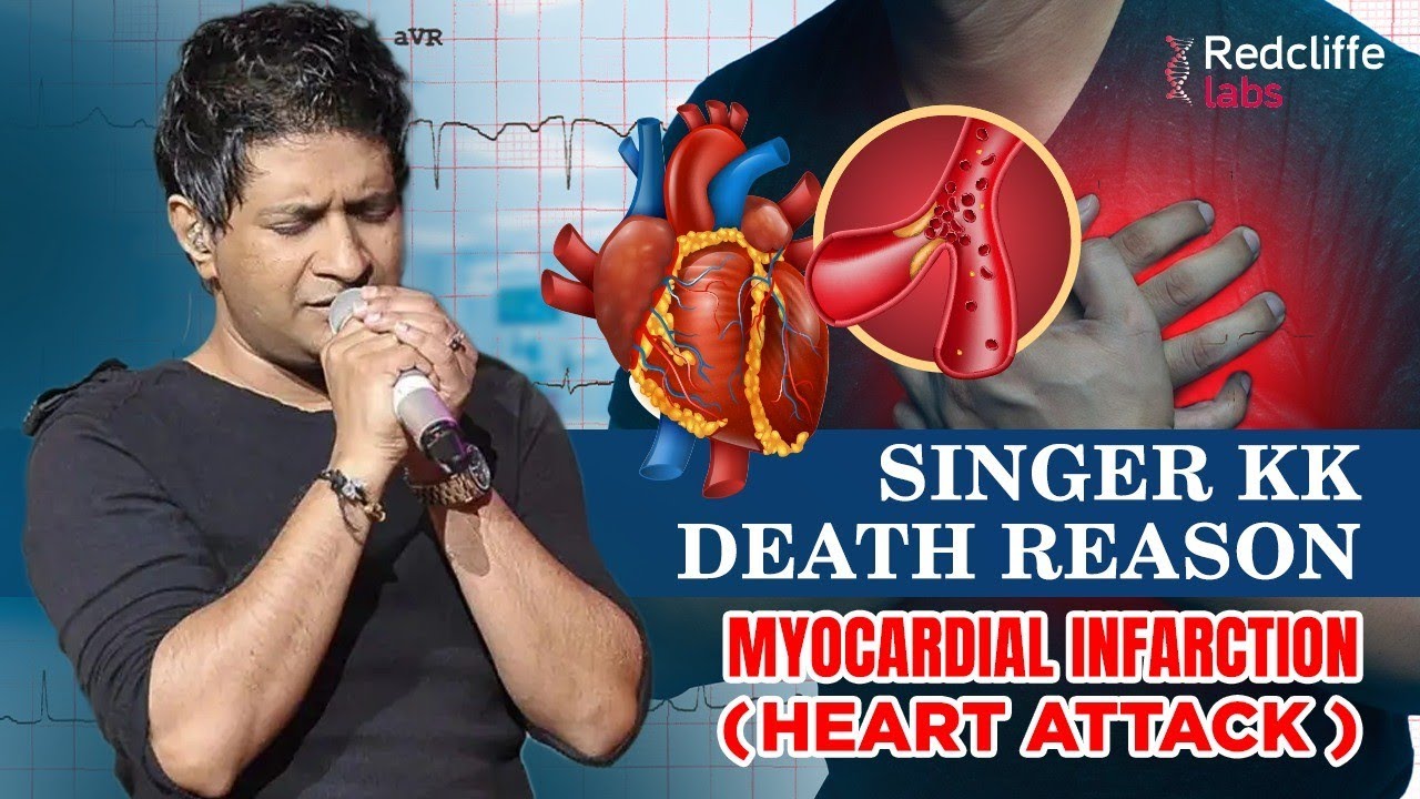 ❇️ Singer KK Death Reason By Doctor in Hindi | What is Myocardial Infarction (Heart Attack) in Hindi