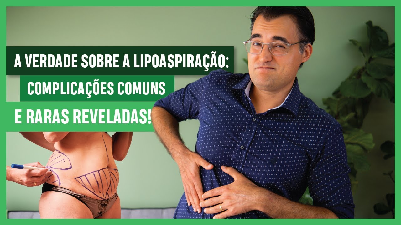 A VERDADE Sobre A LIPOASPIRAÇÃO: COMPLICAÇÕES Comuns e RARAS REVELADAS!