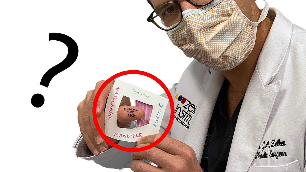 DIY way to tell if buccal fat pad removal surgery is right for you by Dr. Zelken