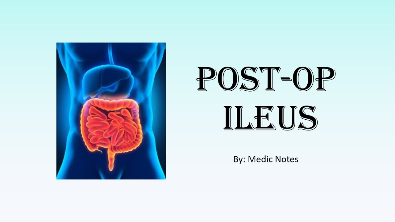 Post-operative ileus - patient and surgical factors, clinical features, investigation, management