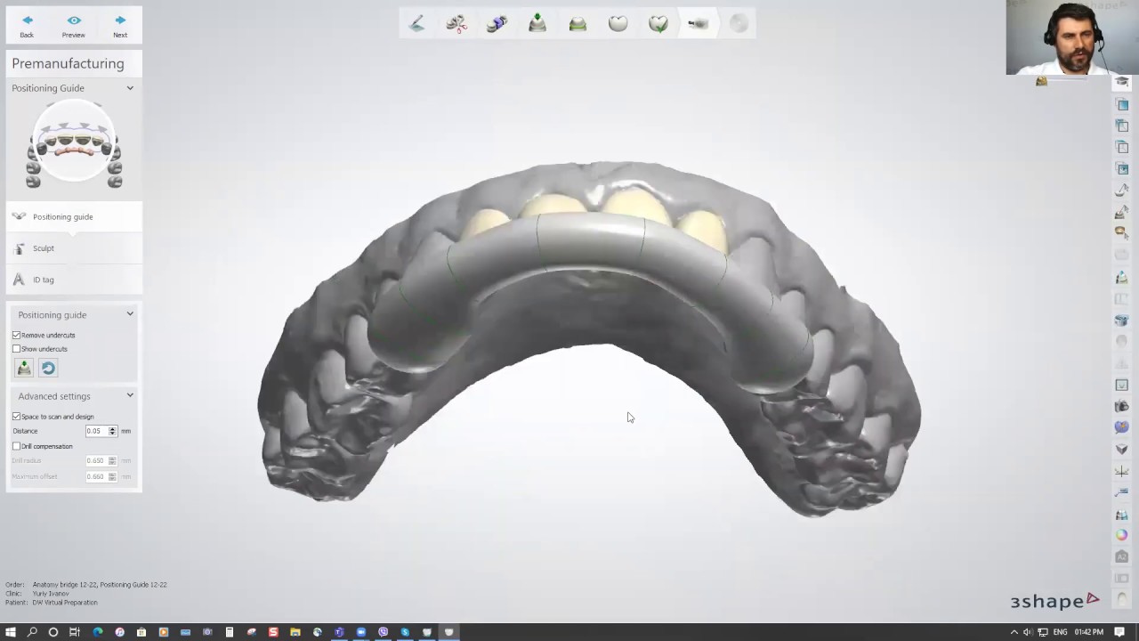 3Shape Virtual Preparation