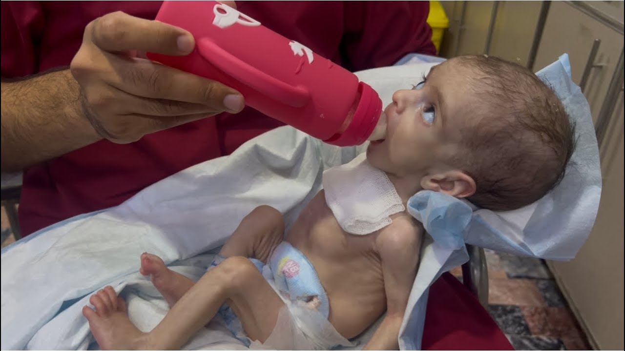  Tiny Fighter: A Little Baby Covered in Wires but Full of Strength! 💪👶