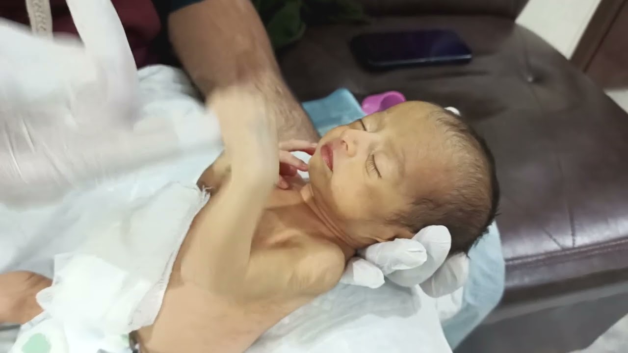 Feeding a Preterm Baby in NICU | Every Drop is Hope 🍼💖