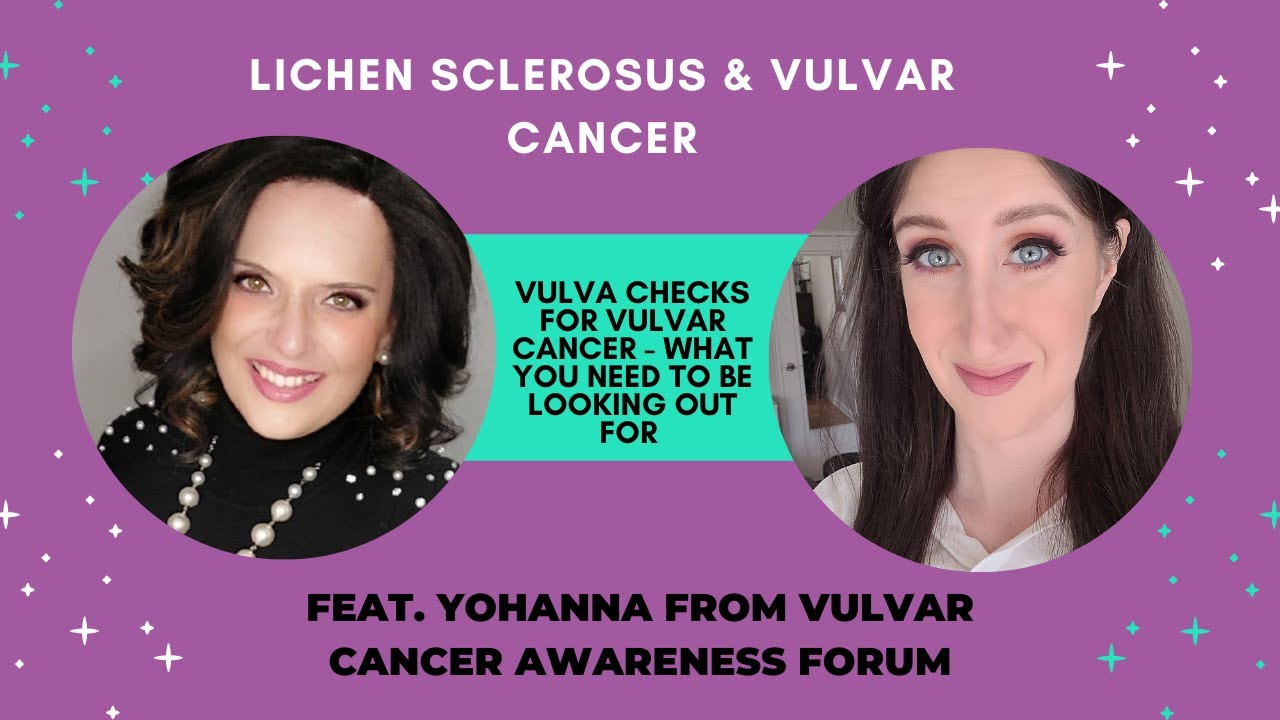 Vulva Checks for Vulvar Cancer: What You Need to be Looking Out For