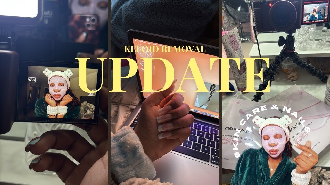 UPDATE | keloid removal update, skincare routine & at home nail salon 🪽
