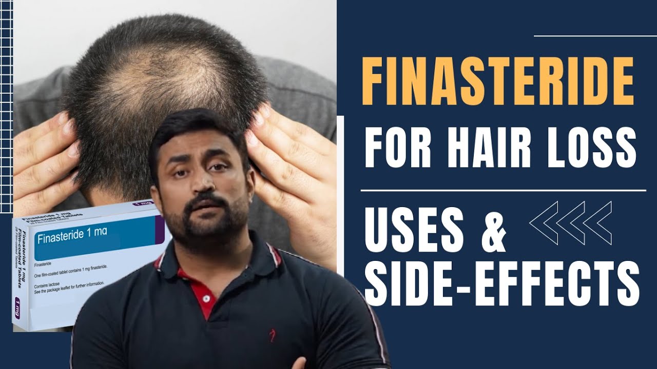FINASTERIDE FOR HAIR LOSS - USES & SIDE EFFECTS