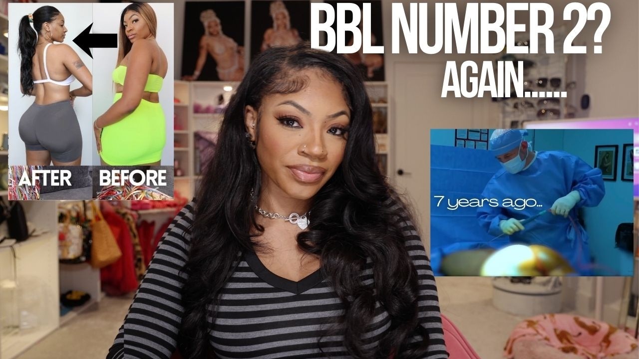 I’m Getting a Second BBL Here’s Why (Full Truth) I documented my journey for 2+ months [ Part 1]