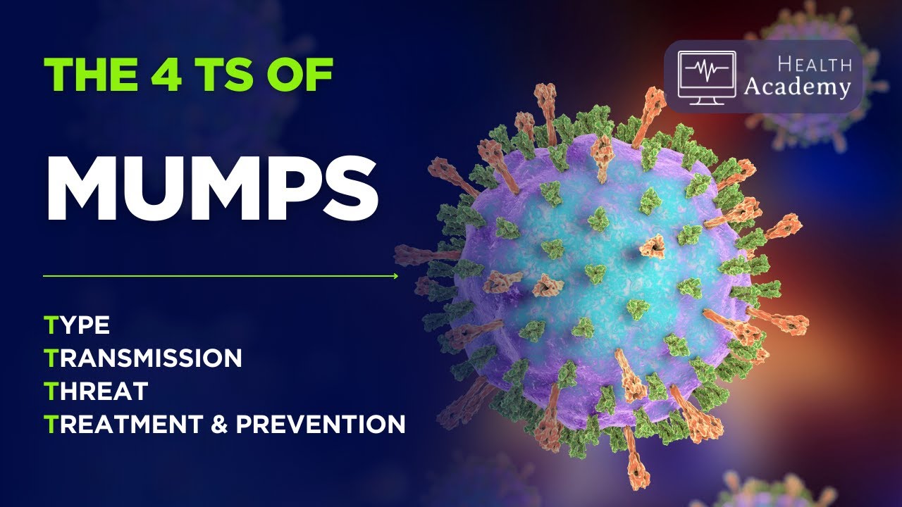 The 4T's of Mumps