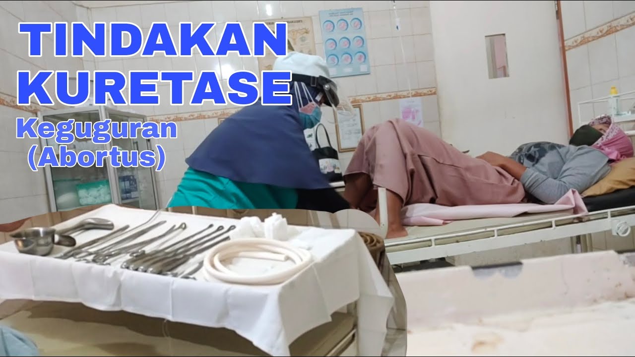 Tindakan kuretase, perkiraan harga kuretase, cerita apakah sakit tindakan kuretase itu? #byrequest