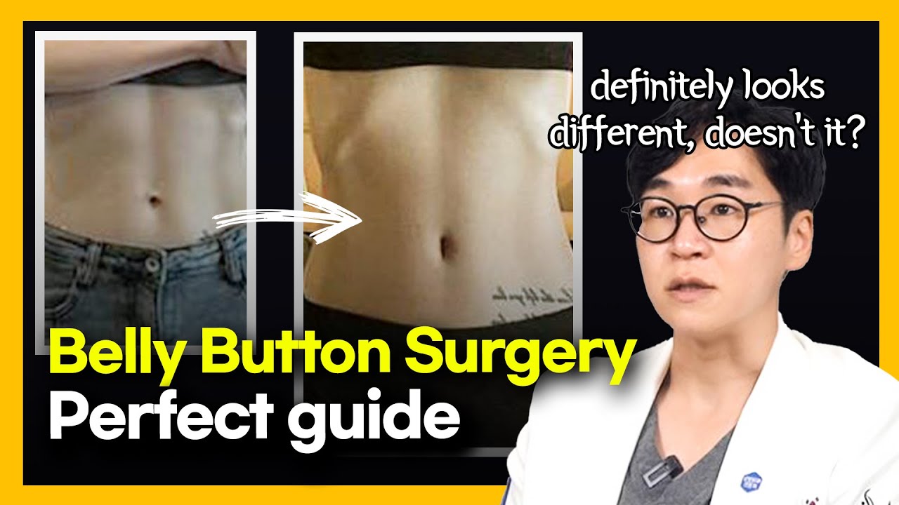 Belly button surgery | Navel surgery  | Umbilicoplasty | Link plastic surgery clinic | Dr. Sung