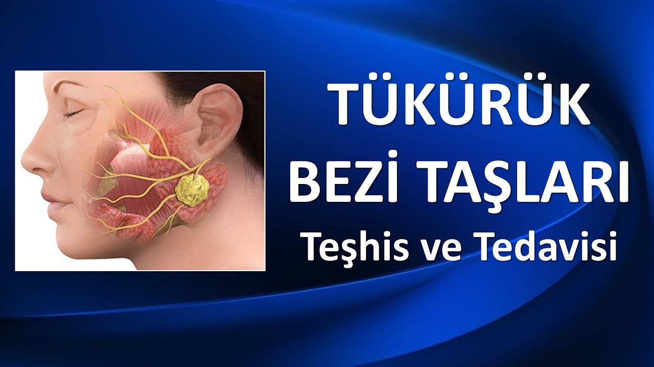 TÜKÜRÜK BEZİ TAŞLARI Teşhis ve Tedavisi