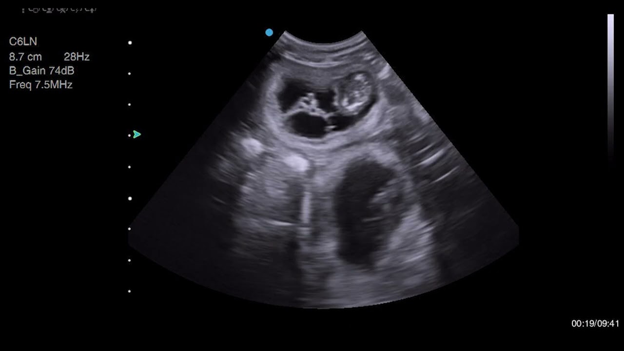 Two Feline Pregnancy Scans