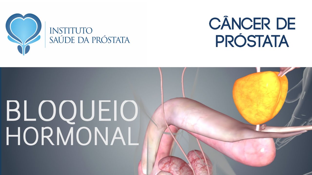 28 - TERAPIA HORMONAL CONTRA O CÊNCER DE PRÓSTATA