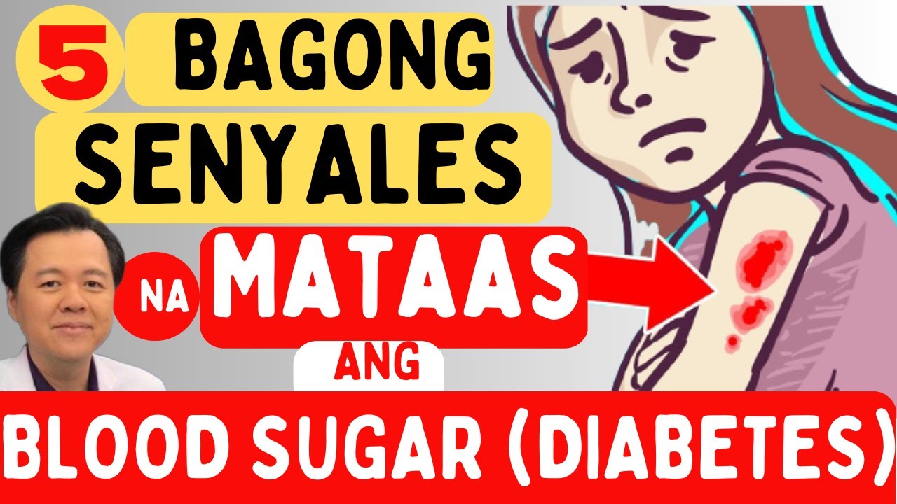 5 Bagong Senyales na Mataas ang Blood Sugar (Diabetes). - By Doc Willie Ong