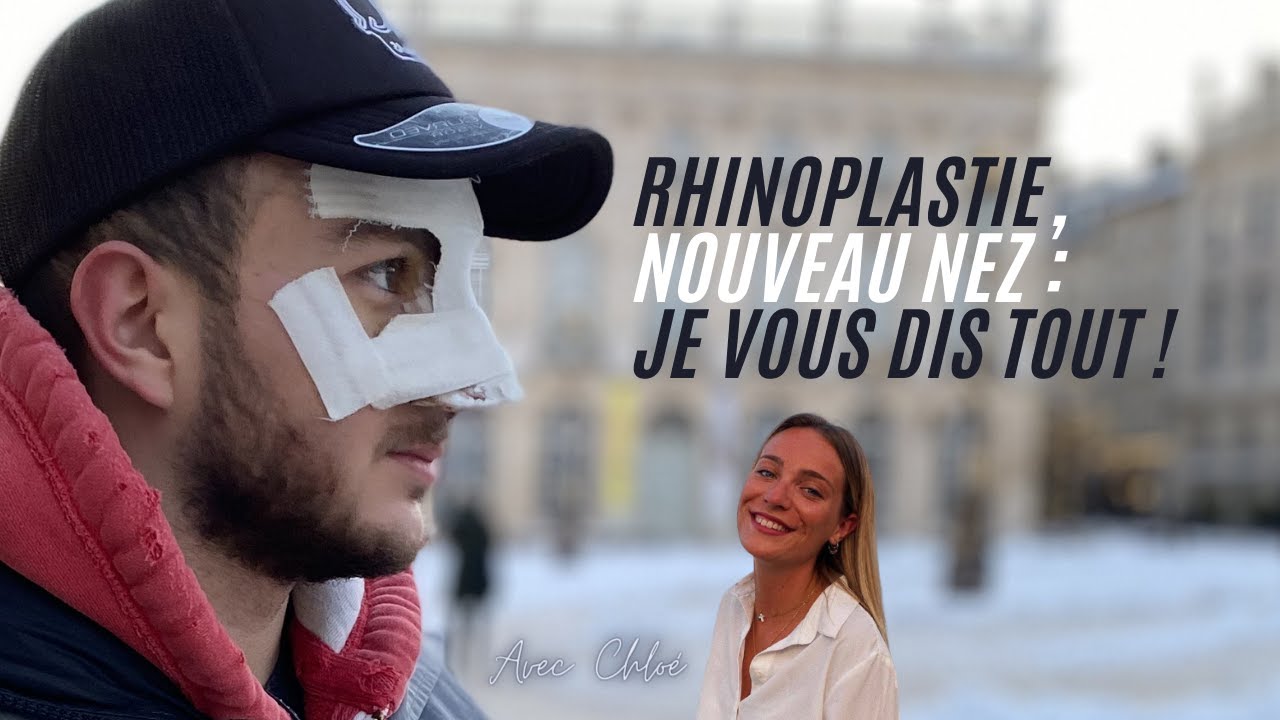 RHINOPLASTIE, NOUVEAU NEZ : JE VOUS DIS TOUT !
