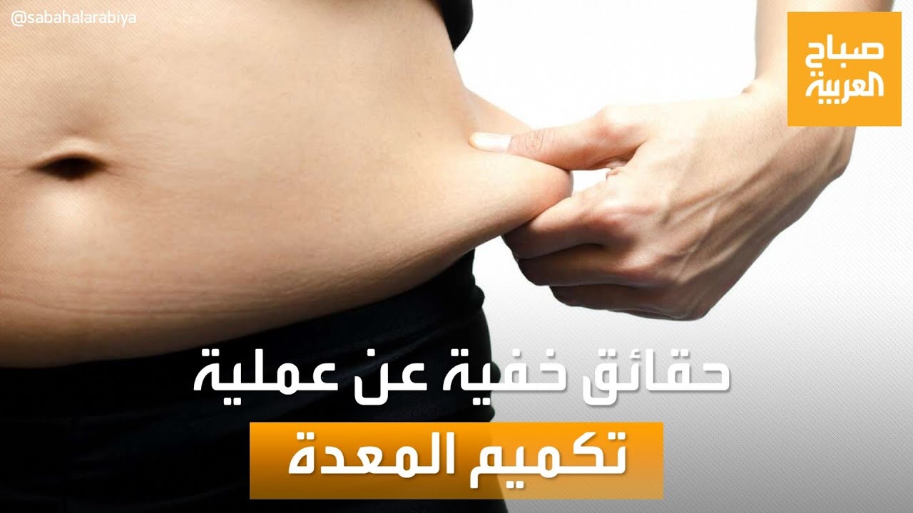 صباح العربية | أسوأ جراحة بتاريخ الطب؟.. حقائق خفية عن عملية تكميم المعدة