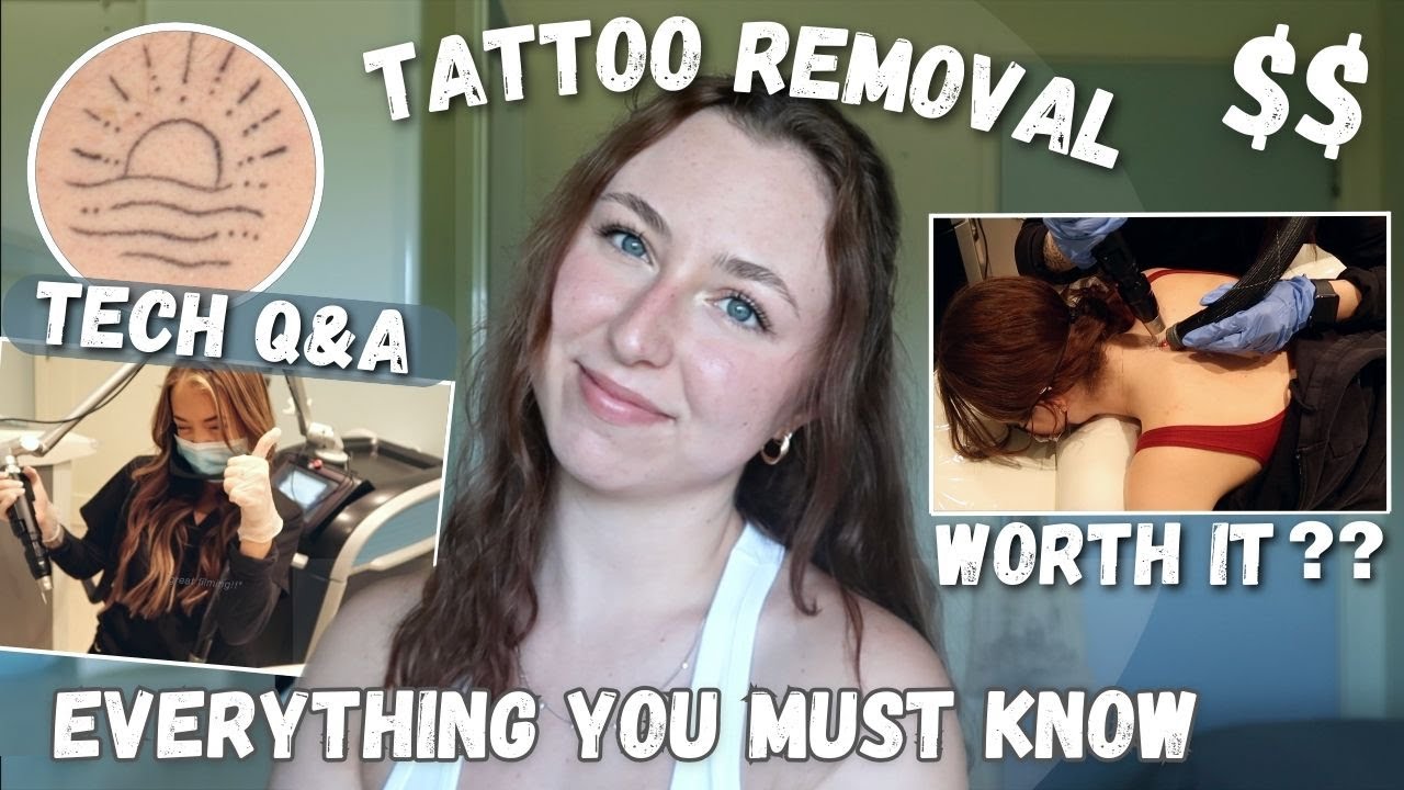 getting laser tattoo removal at 20! (everything you've ever wanted to know)