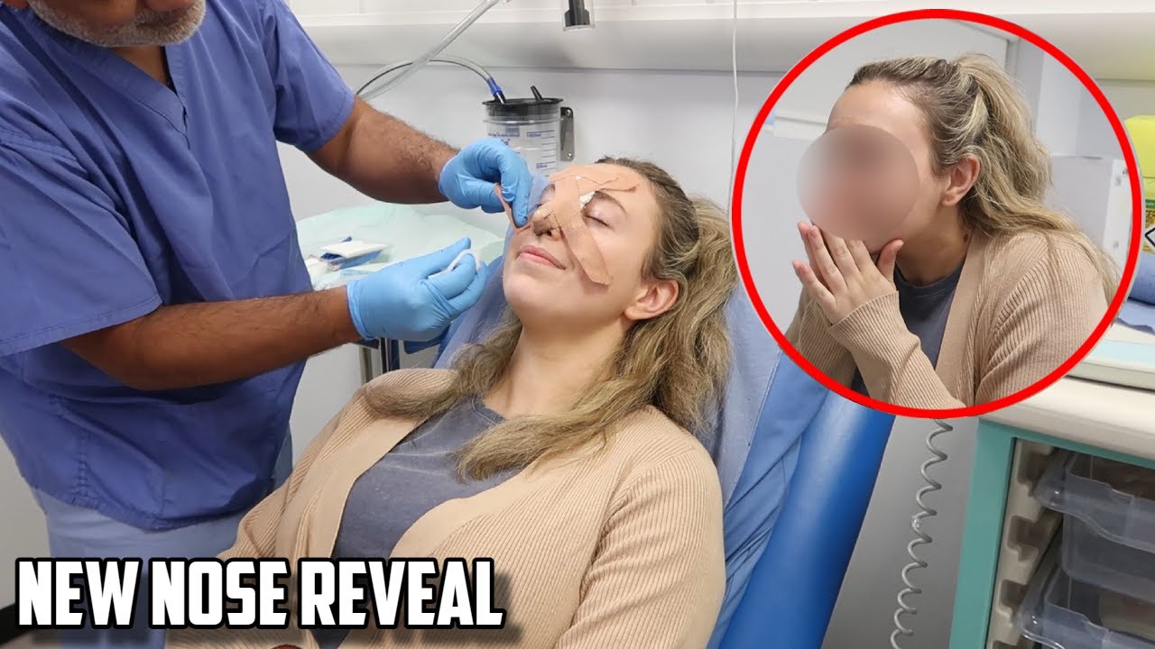Seeing what my face looks like I Nose Job Cast Removal