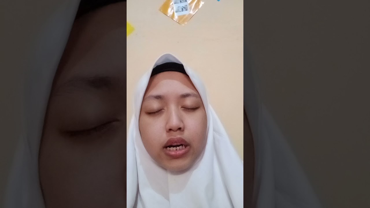 prosedur pembidaian pada fraktur