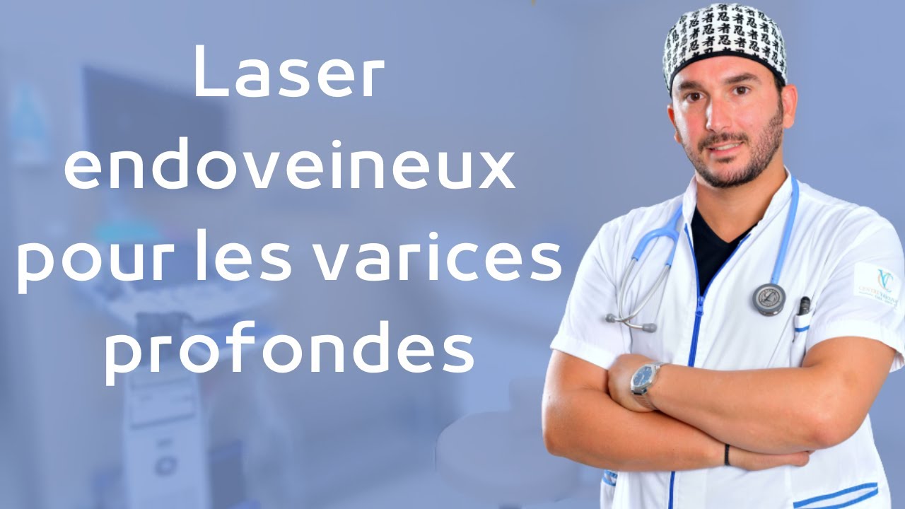 Laser endoveineux pour les varices profondes