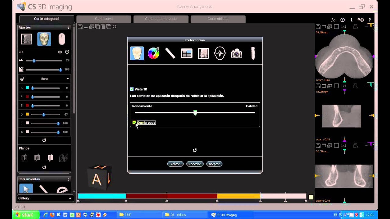 Tutorial CS 3D imaging software. 08-Carestream. Ajustes ventana 3D.avi