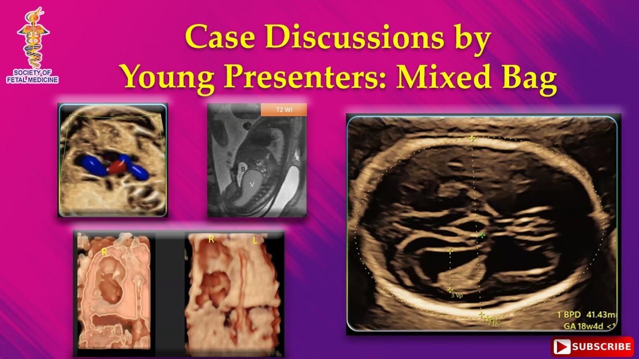 Case Discussions by Young Presenters: Mixed Bag