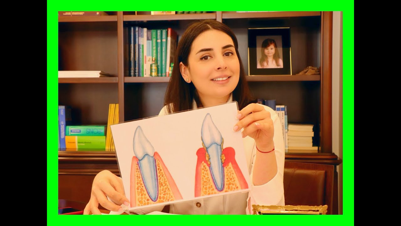 Periodontitis nedir? | Küretaj tedavisi kimlere ve nasıl yapılır?