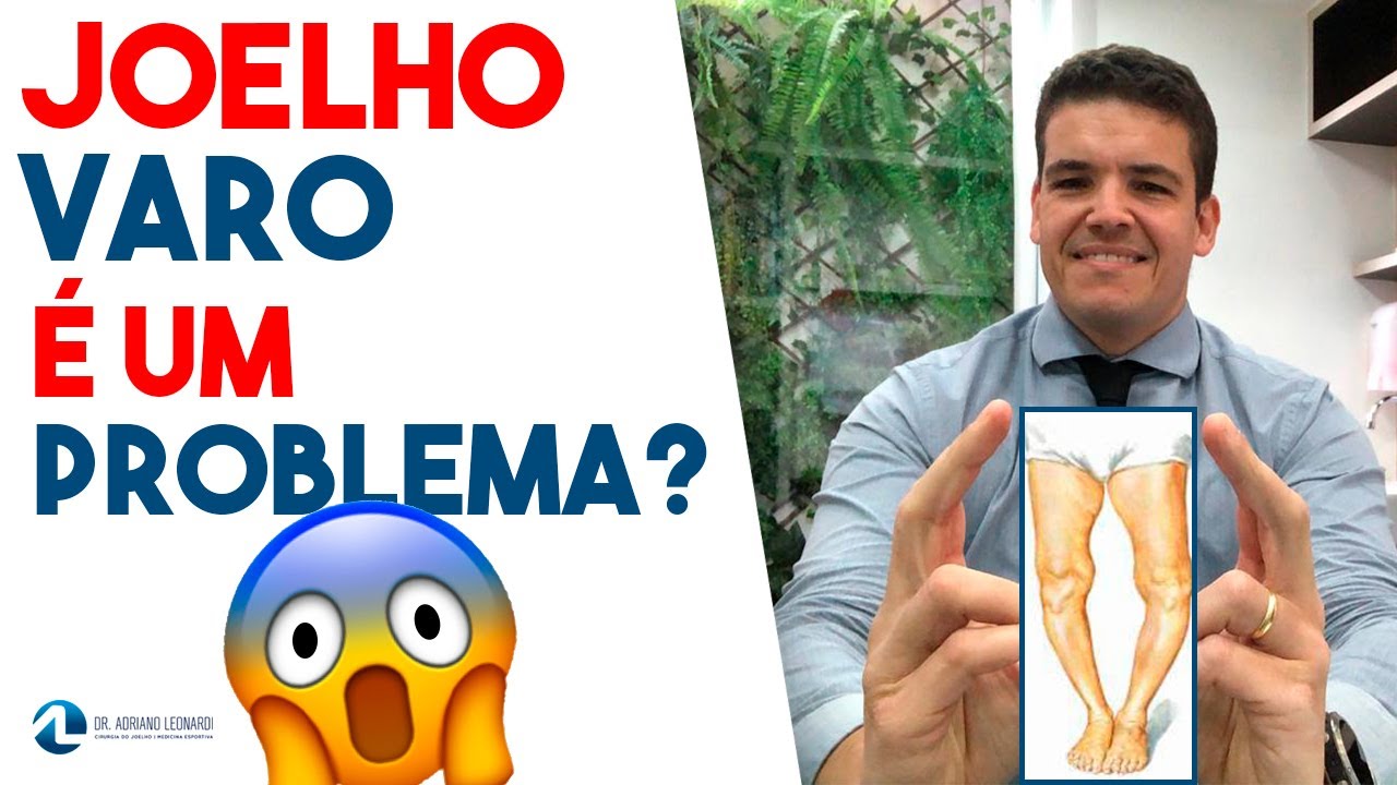 JOELHO VARO é um problema?