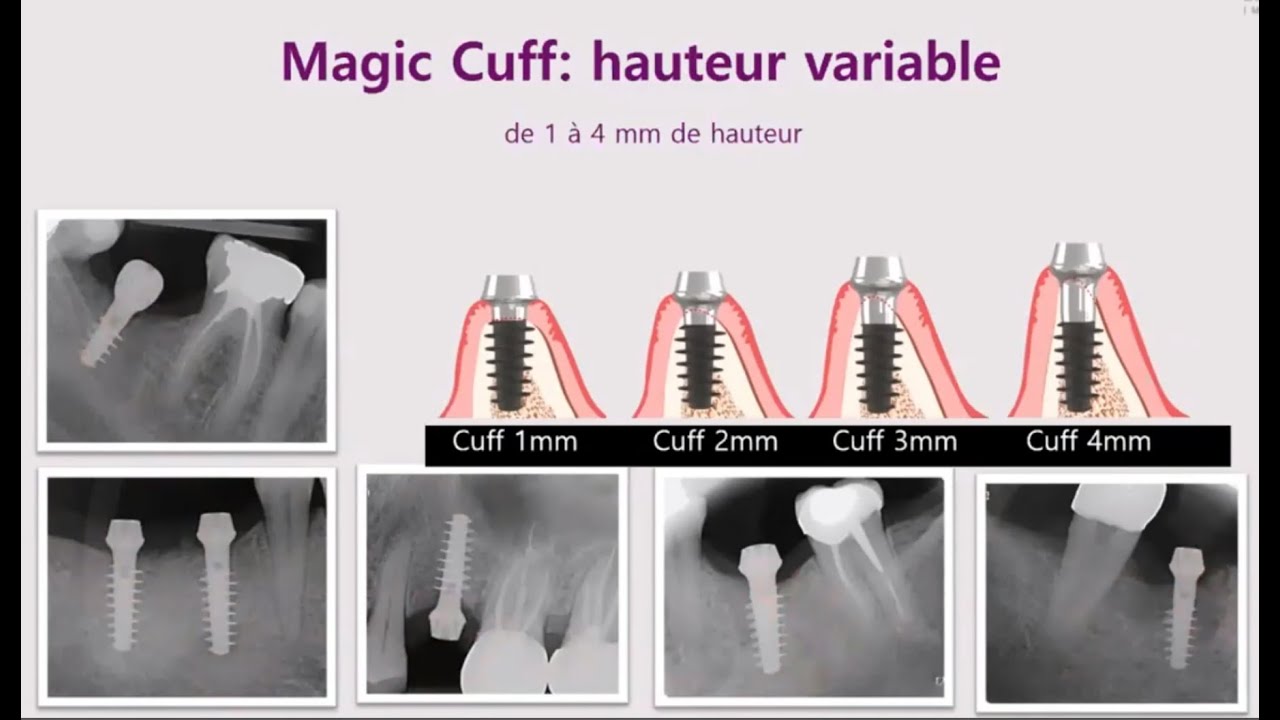 Webinar Dr  Bousquet Oct 2024