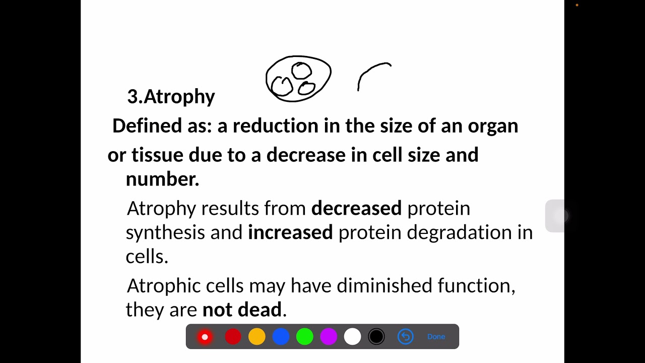 🔥Pathology Course - Lecture 2- Adaptation