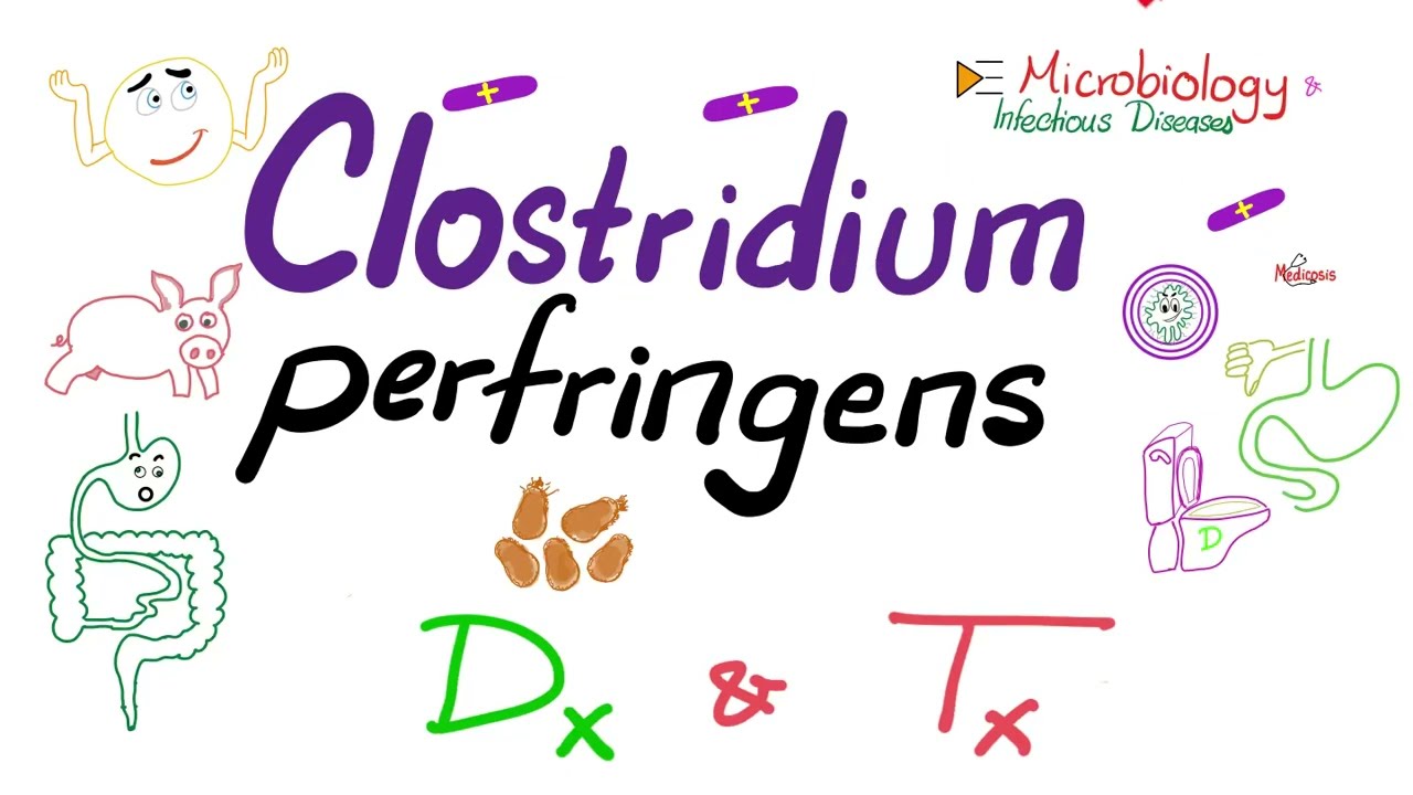 Clostridium perfringens Diagnosis and Treatment | Microbiology 🧫 & Infectious Diseases